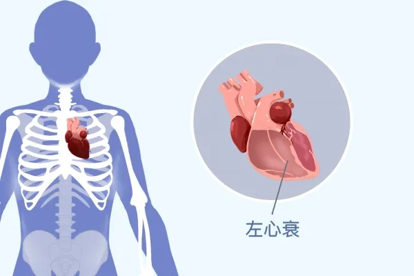 冠心病的症状表现在哪些方面