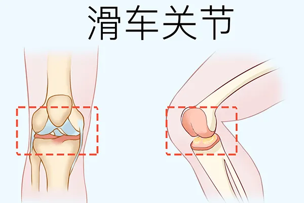 爬山减肥有什么好处