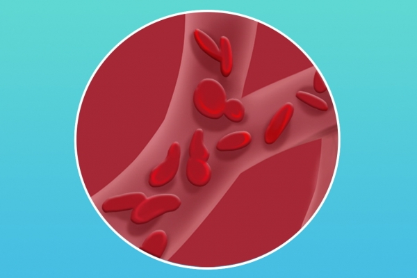 血红蛋白浓度偏高是什么意思