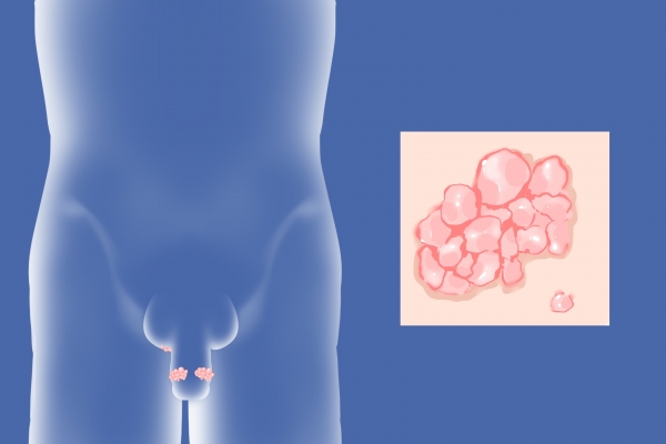 艾滋传播途径(图2) 艾滋传播途径