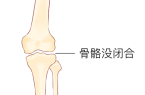 拉单杠能长高吗