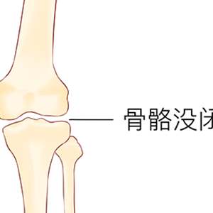 拉单杠能长高吗